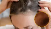 Şampuanın içine sadece 2 damla ekleyin! Saçlarınız Rapunzel gibi uzayacak