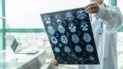 Beyni 20 Yıl Yaşlandıran Hata! Alzheimer İlk Sinyali 30'lu Yaşlarda