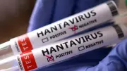 BM'den hantavirüs açıklaması: Genel nüfus için risk düşük