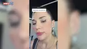 Buse Varol'dan estetik itirafı: Sosyal medyayı salladı