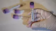 Hantavirüs Türkiye'de Görüldü mü? Belirtileri ve Bulaşma Yolları Neler?