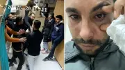 Hatay'da doktor hastaya yumruk attı: Yüzde 30 görme kaybı