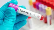 Norovirüs uyarısı: Mide bulantısı ve ani kusmaya dikkat