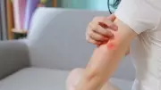 Pencere Önüne Sadece 2 Tanesini Koyun: Tek Bir Sinek Bile Yaklaşamıyor!