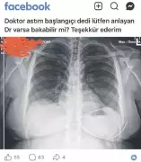 Sanal muayene çılgınlığı: Facebook'tan röntgen paylaşan kadın
