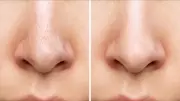 Siyah Noktaları Kökünden Söken 2 Malzemeli Maske Tarifi