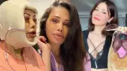 Yüz Nakli Olan Didem Ceran'ın Son Hali Sosyal Medyada Gündem Oldu