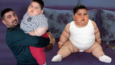 Yağız'ın İnanılmaz Değişimi: 5 Yaşında 90 Kiloydu, Şimdi 40 Kilo