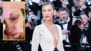 Bella Hadid Lyme Hastalığıyla Mücadelesini Gözyaşları İçinde Anlattı