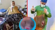 Karnından 40 kilo kitle çıktı! Doktorlar bile şaşkın
