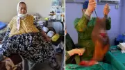 Karnından 40 Kilogramlık Kitle Çıkarılan Kadın Sağlığına Kavuştu