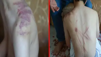 Elazığ'da 14 yaşındaki engelli çocuğa şiddet: Baba adliyeye başvurdu