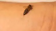 Arı Sokması Sonucu 2 Günde Hayatını Kaybetti! Uzmanlardan Hayati Uyarılar