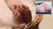 Avustralya'da 15 Milyonda Bir Görülen Tek Yumurta Dördüzleri Doğdu