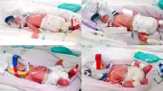 Avustralya'da ilk: 15 milyonda bir görülen tek yumurta dördüzleri doğdu