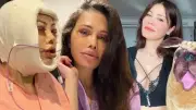 Didem Ceran İkinci Kez Yüz Nakli Oldu: 'En İyi Niyetli Olduğum Yerlerden Cezalandırıldım'