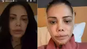 Didem Ceran Yüz Nakli Sonrası Kendini Camila Cabello ile Karşılaştırdı