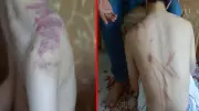 Elazığ'da 14 yaşındaki engelli çocuğa şiddet: Baba adliyeye başvurdu