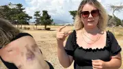 Eski sevgilisi 30 yerinden bıçakladı! Bıçak sırtında kırıldı, saldırı devam etti