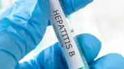 Hepatit B ve C'de erken tanı tedavi başarısını artırıyor