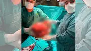 Karnından 6.5 kg tümör çıktı! Ameliyat korkusu 1.5 yıl ertelemişti