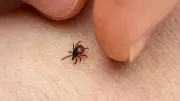 Park ve Piknik Sonrası Kene Kontrolü Hayat Kurtarır