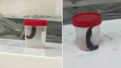Siirt'te çeşmeden su içen çocuğun boğazından sülük çıkarıldı