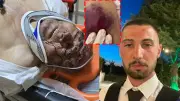 Çanakkale'de 150 bardak çay borcu için öldüresiye dövüldü