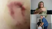 Bolu'da 7 yaşındaki çocuğu ısıran köpek sahibinin savunması