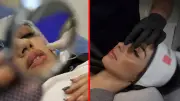Estetik yaşı ortaokullara indi: 11 yaşındakiler dolgu istiyor
