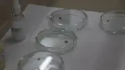 Ordu'da Kene Tutunan Kadın Sivas'ta Hayatını Kaybetti