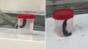 Siirt'te çeşmeden su içen çocuğun boğazından sülük çıkarıldı